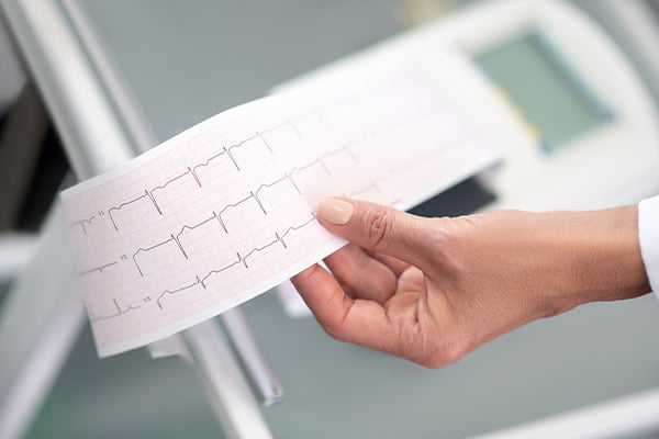Kardiolog Elektrokardiogram